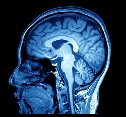 MRI-image-of-the-human-brain